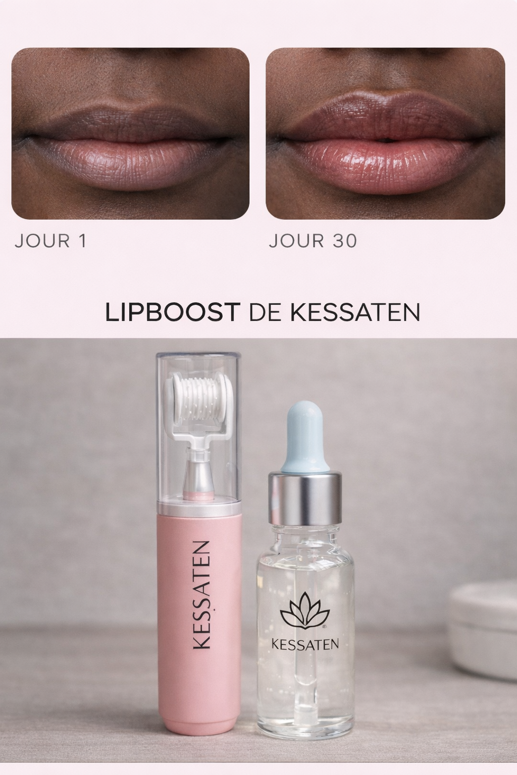 LipBoost KESSATEN – Dermaroller Visage & Lèvres avec Micro-Aiguilles en Titane + Soin Acide Hyaluronique Offert