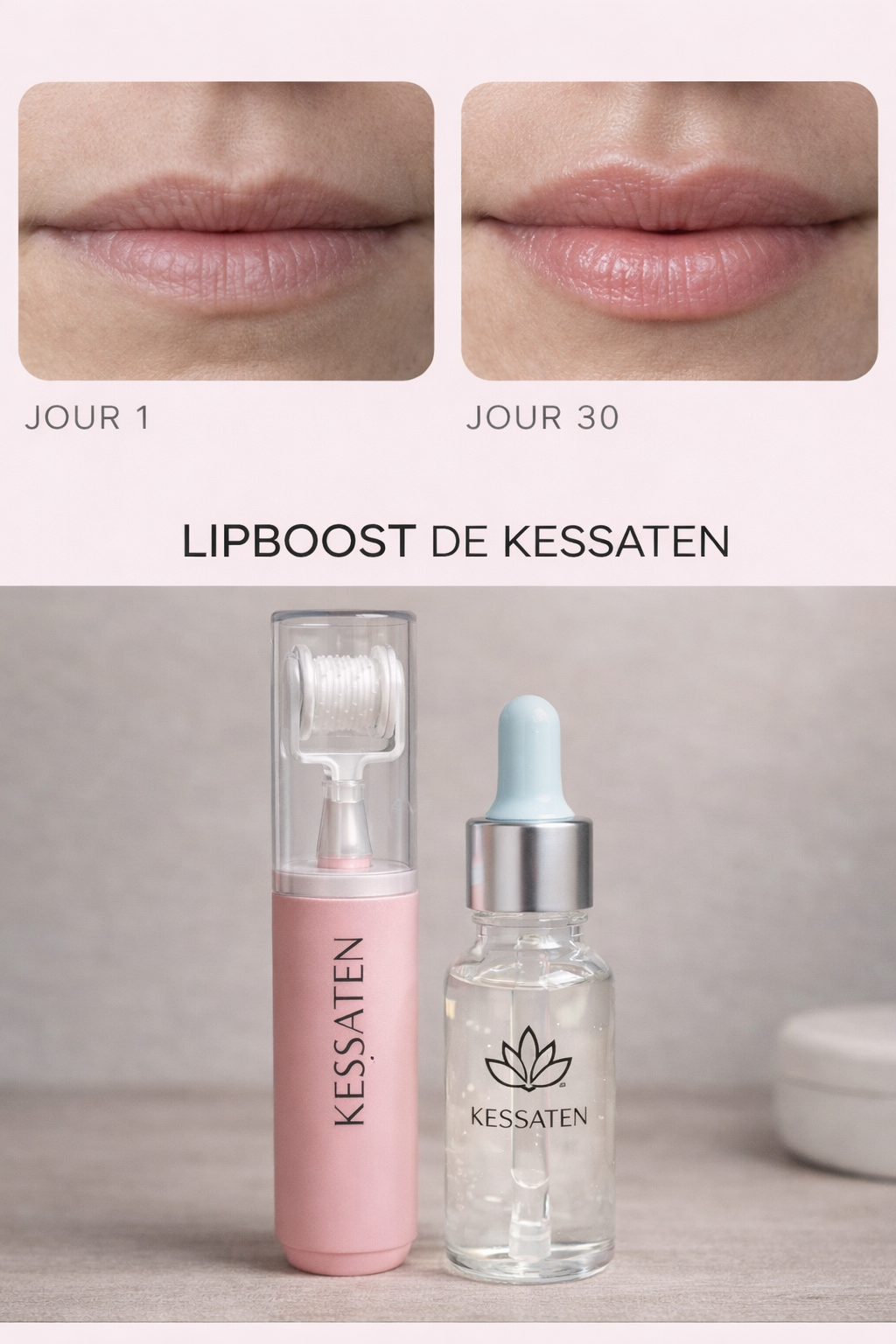 LipBoost KESSATEN – Dermaroller Visage & Lèvres avec Micro-Aiguilles en Titane + Soin Acide Hyaluronique Offert